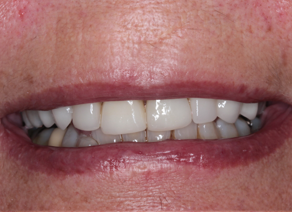 After - Caversham Heights Dental Practice